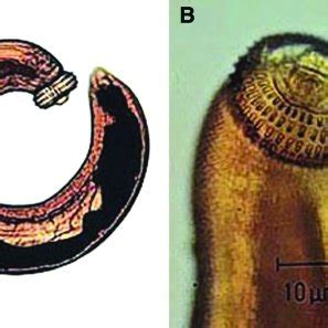  Gigantostoma Spinigerum: Un gusano gigante que causa estragos en la piel de sus huéspedes