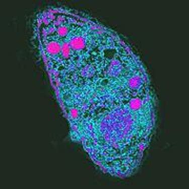  Toxoplasma gondii: Un Parásito Astuto que Puede Manipular la Mente de sus Huéspedes!