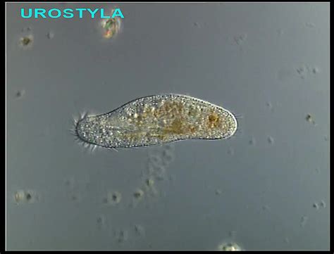  Urostyla! Un Ciliado Con Forma de Estrella que Danza Entre las Algas